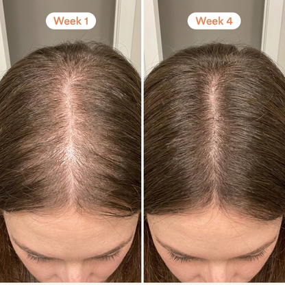 Heartleaf Exosome Hair Ampoule